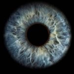 Opération au femto-lasik lasik 100% laser lasik sans lame
