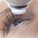 Opération Lasik